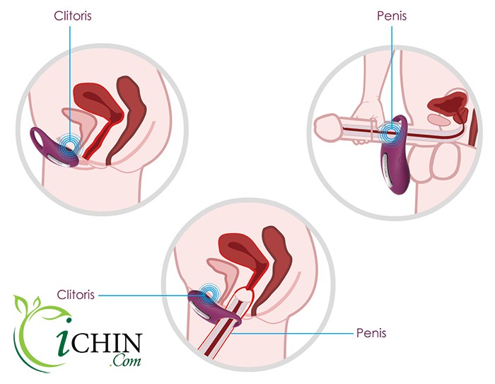 Svakom Winni vòng rung điều khiển từ xa cao cấp USA sản phẩm chính hãng Svakom Winni vòng rung điều khiển từ xa cao cấp USA sản phẩm chính hãng